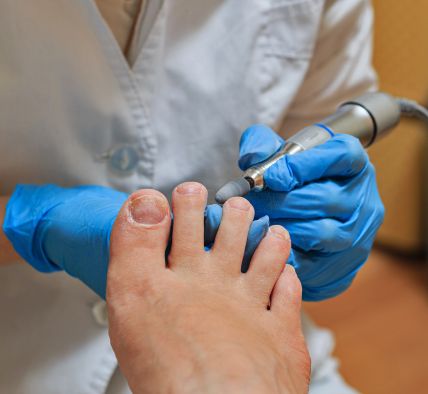 Dúvidas sobre podologia em Várzea Paulista