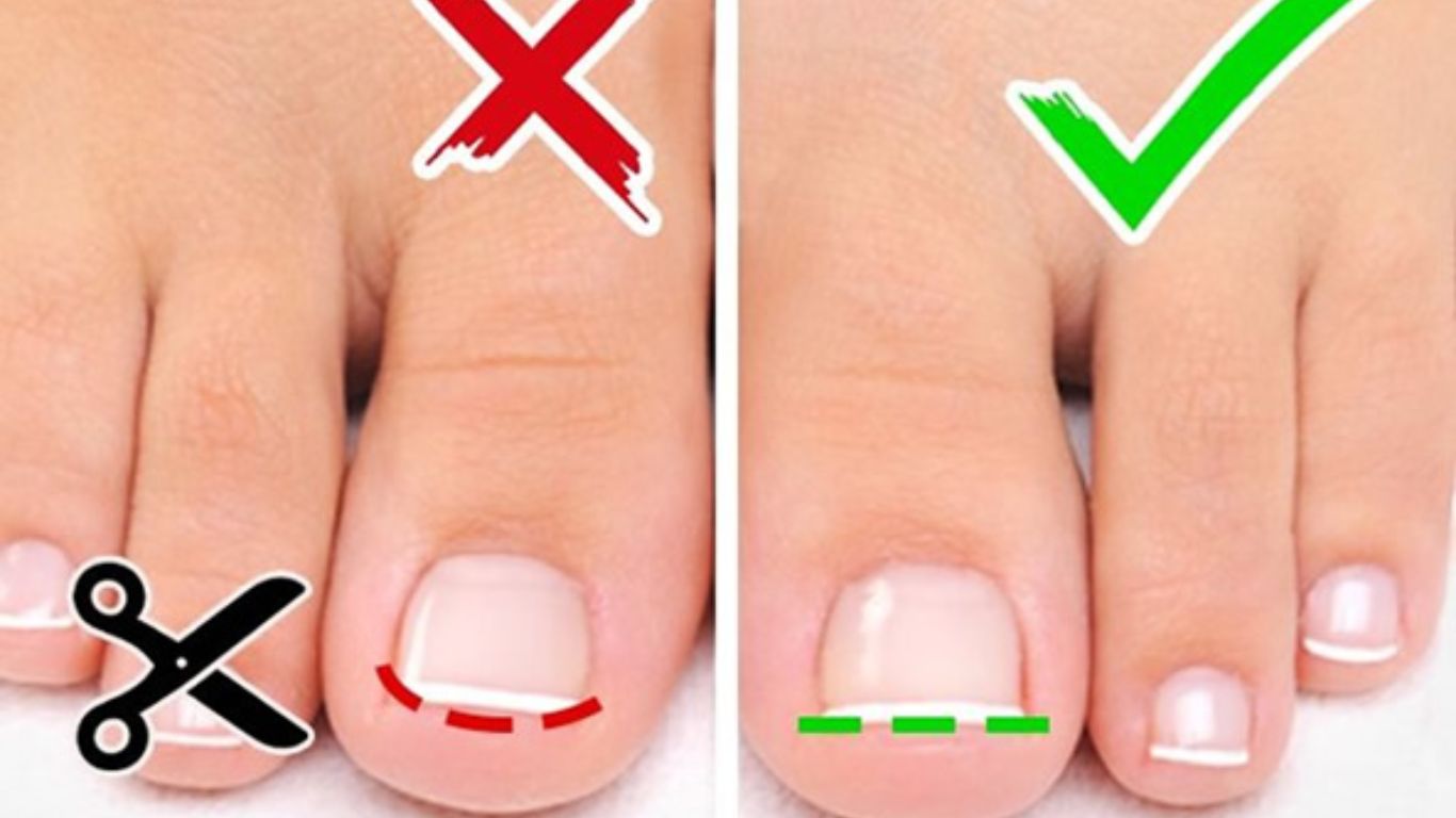 Como cortar unhas podologia Várzea Paulista