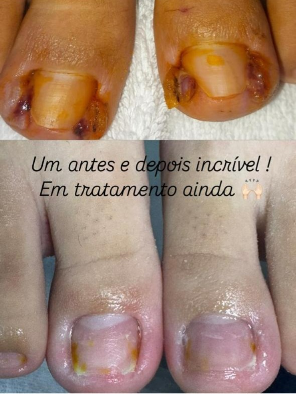 Cliente podologia Várzea Paulista